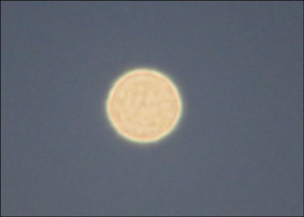 Venus-Foto Zoom